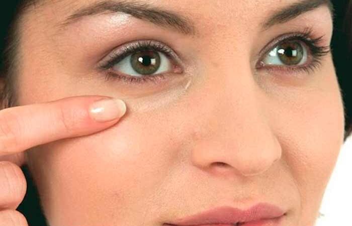 Самые лёгкие способы избавиться от отёков под глазами в домашних условиях