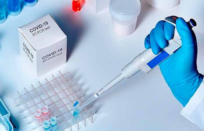 ПЦР-тест на коронавирус: где сделать в Киеве и сколько это стоит