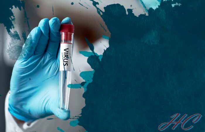 В Киевской области от COVID-19 скончались трое человек