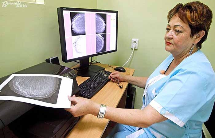 В течение месяца киевлянки могут бесплатно сделать маммографию