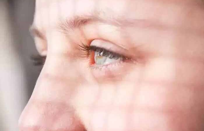 Як позбутися мішків під очима після свят