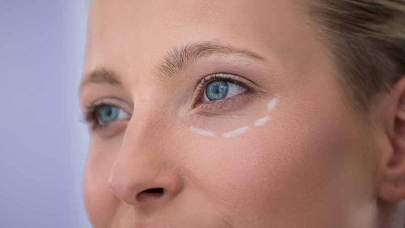 Як швидко позбутися синців під очима: спрацює лише один спосіб